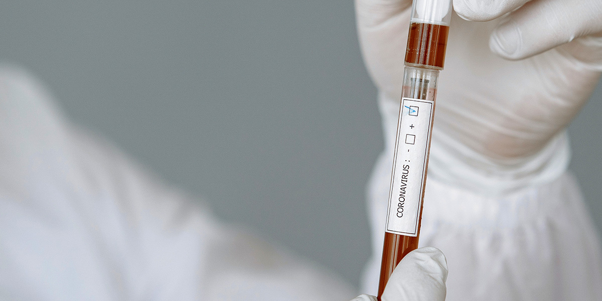 deteksi-dini-covid-19-gugus-tugas-mimika-siapkan-rapid-test-massal